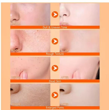 Exfoliating Kojic Acid Turmeric Spray 400 ml Pack of 2