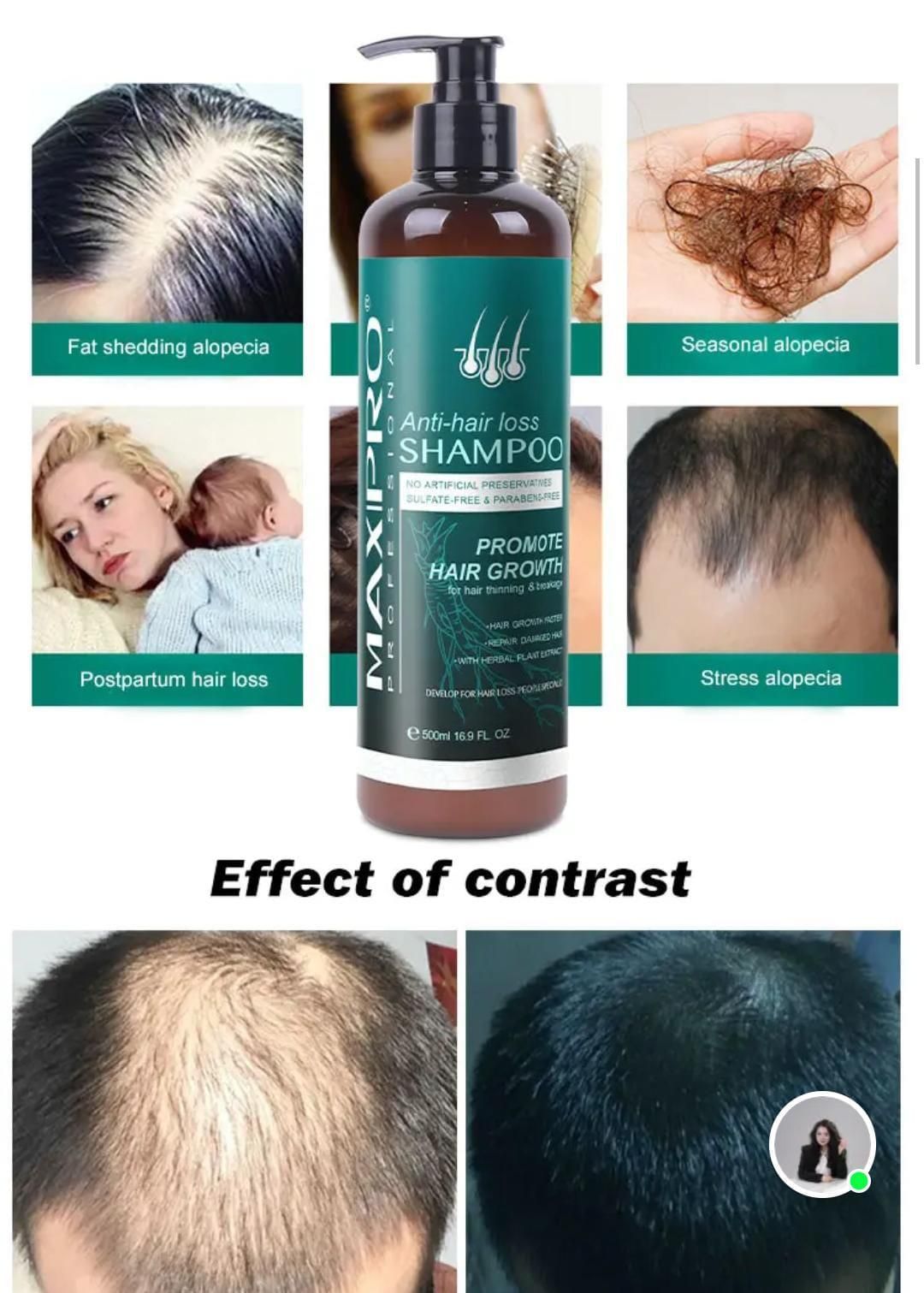 Anti Hair Loss Shampoo & Conditioner 500 ml (Pack of 2)