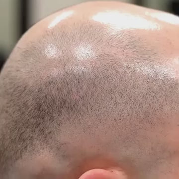 Follicure BioGrow Hair Restoration Spray 50 ml (Pack of 1)